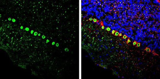 BCL6 Antibody in Immunohistochemistry (Frozen) (IHC (F))