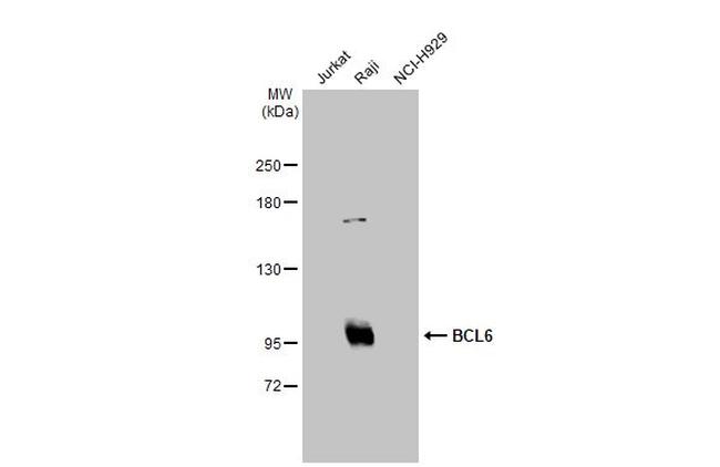 BCL6 Antibody in Western Blot (WB)