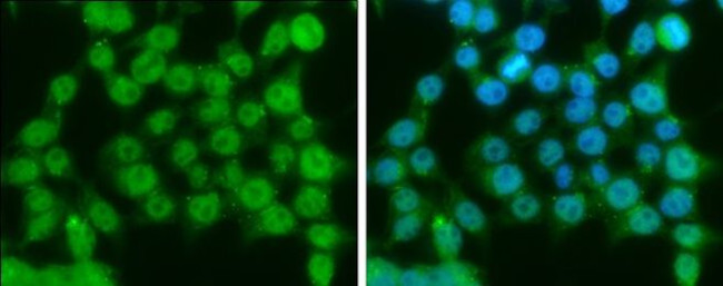 Ataxin 3 Antibody in Immunocytochemistry (ICC/IF)