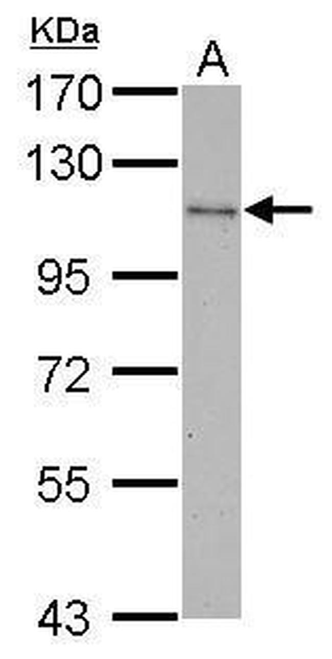 c-Cbl Antibody in Western Blot (WB)