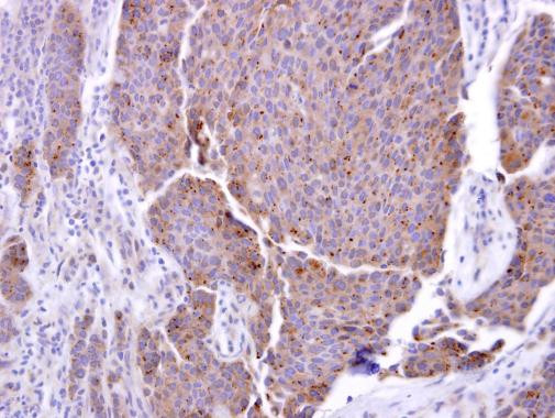 ADAM17 Antibody in Immunohistochemistry (Paraffin) (IHC (P))