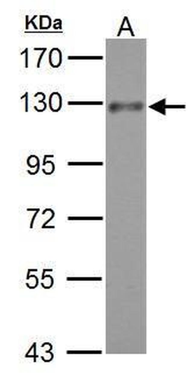 ADAM17 Antibody in Western Blot (WB)