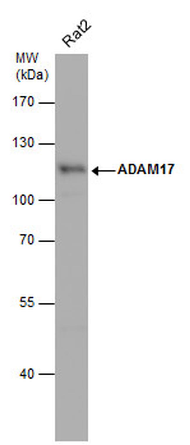 ADAM17 Antibody in Western Blot (WB)