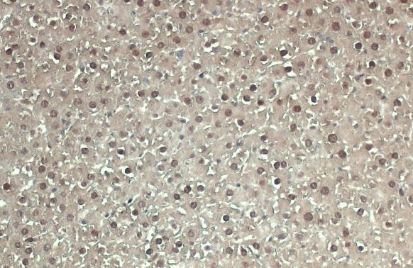 Adenosine Kinase Antibody in Immunohistochemistry (Paraffin) (IHC (P))