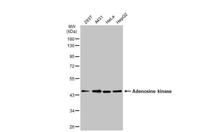 Adenosine Kinase Antibody in Western Blot (WB)