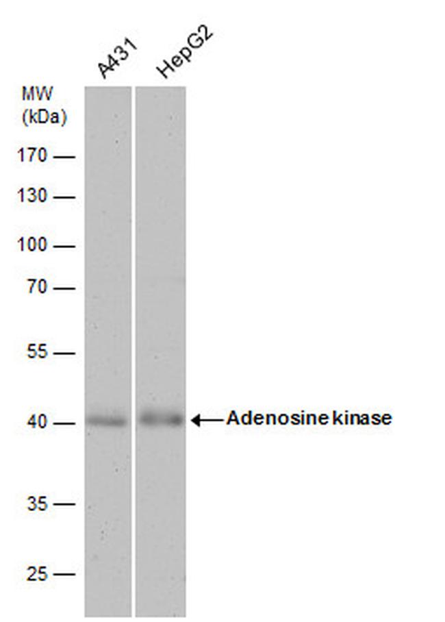 Adenosine Kinase Antibody in Western Blot (WB)