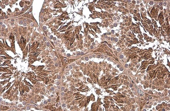 PGK1 Antibody in Immunohistochemistry (Paraffin) (IHC (P))