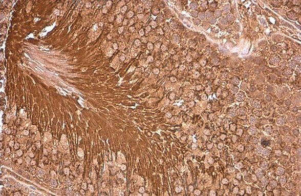 PGK1 Antibody in Immunohistochemistry (Paraffin) (IHC (P))