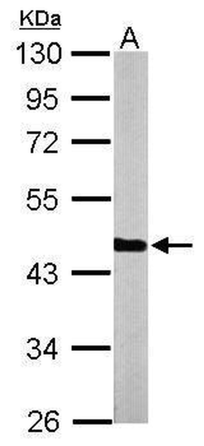 PGK1 Antibody in Western Blot (WB)