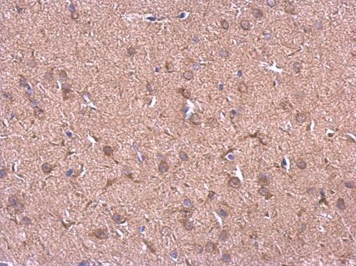 HSP90 beta Antibody in Immunohistochemistry (Paraffin) (IHC (P))