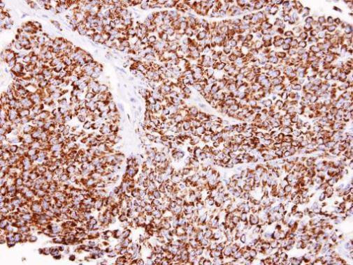 ALDH2 Antibody in Immunohistochemistry (Paraffin) (IHC (P))