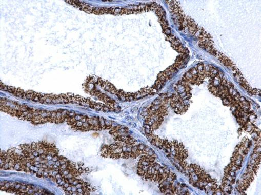 ALDH2 Antibody in Immunohistochemistry (Paraffin) (IHC (P))