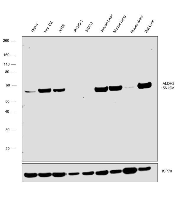 ALDH2 Antibody in Western Blot (WB)