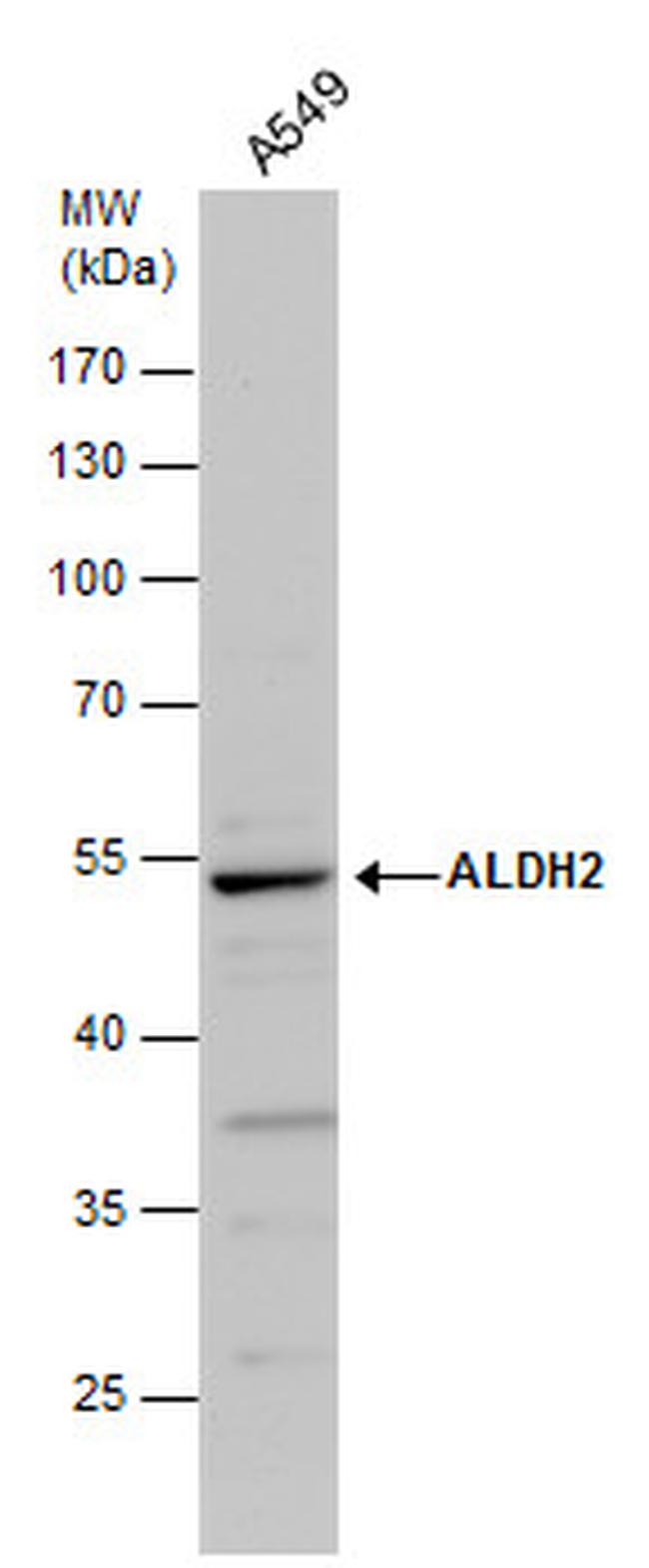 ALDH2 Antibody in Western Blot (WB)