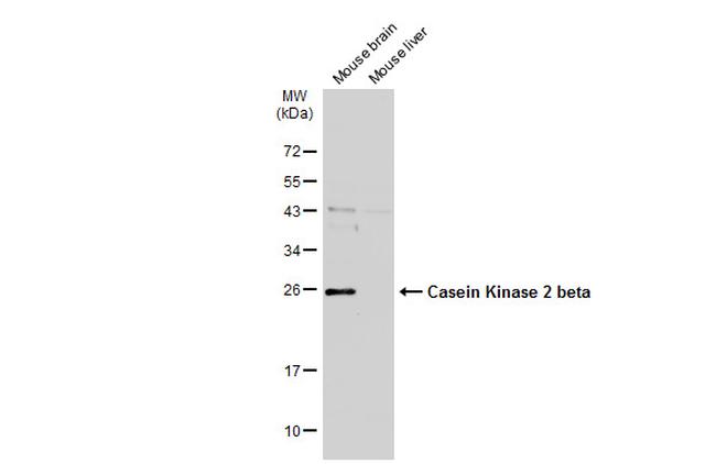 CK2 beta Antibody in Western Blot (WB)