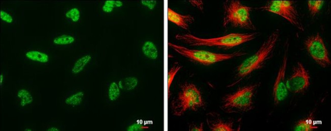 UAP56 Antibody in Immunocytochemistry (ICC/IF)