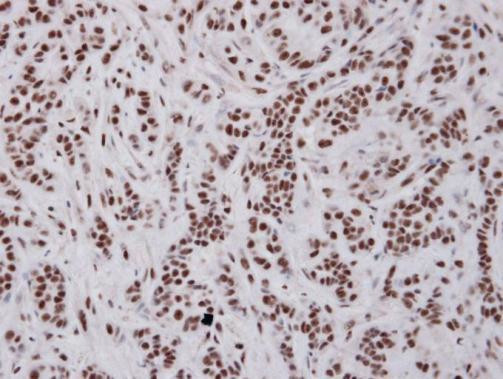 UAP56 Antibody in Immunohistochemistry (Paraffin) (IHC (P))