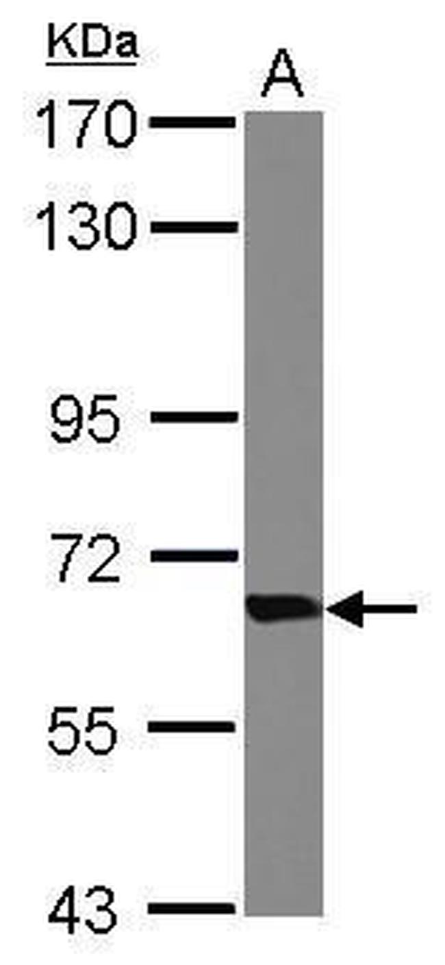 Transketolase Antibody in Western Blot (WB)