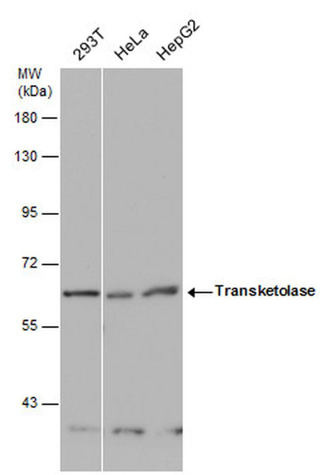 Transketolase Antibody in Western Blot (WB)