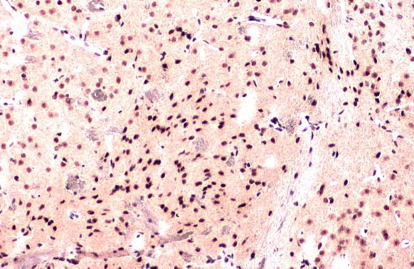 hnRNP A1 Antibody in Immunohistochemistry (Paraffin) (IHC (P))