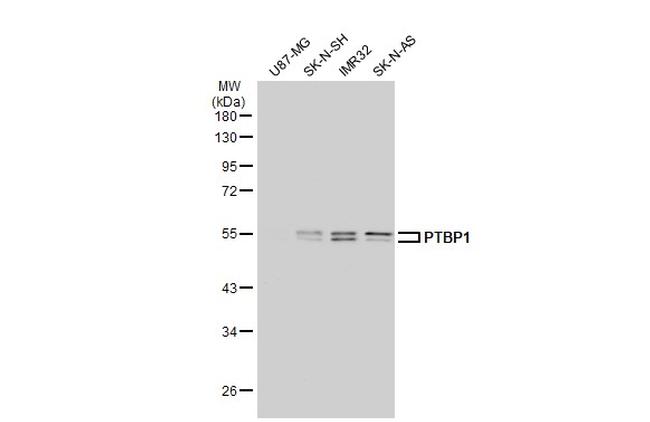 hnRNP A1 Antibody in Western Blot (WB)