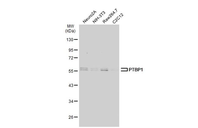 hnRNP A1 Antibody in Western Blot (WB)