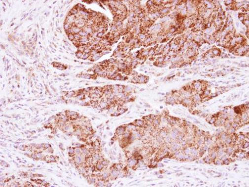 KNP-I Antibody in Immunohistochemistry (Paraffin) (IHC (P))