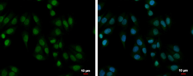 PABPN1 Antibody in Immunocytochemistry (ICC/IF)