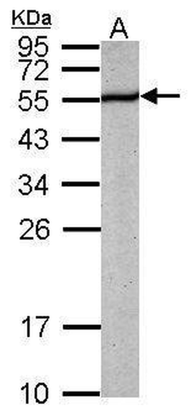 PABPN1 Antibody in Western Blot (WB)