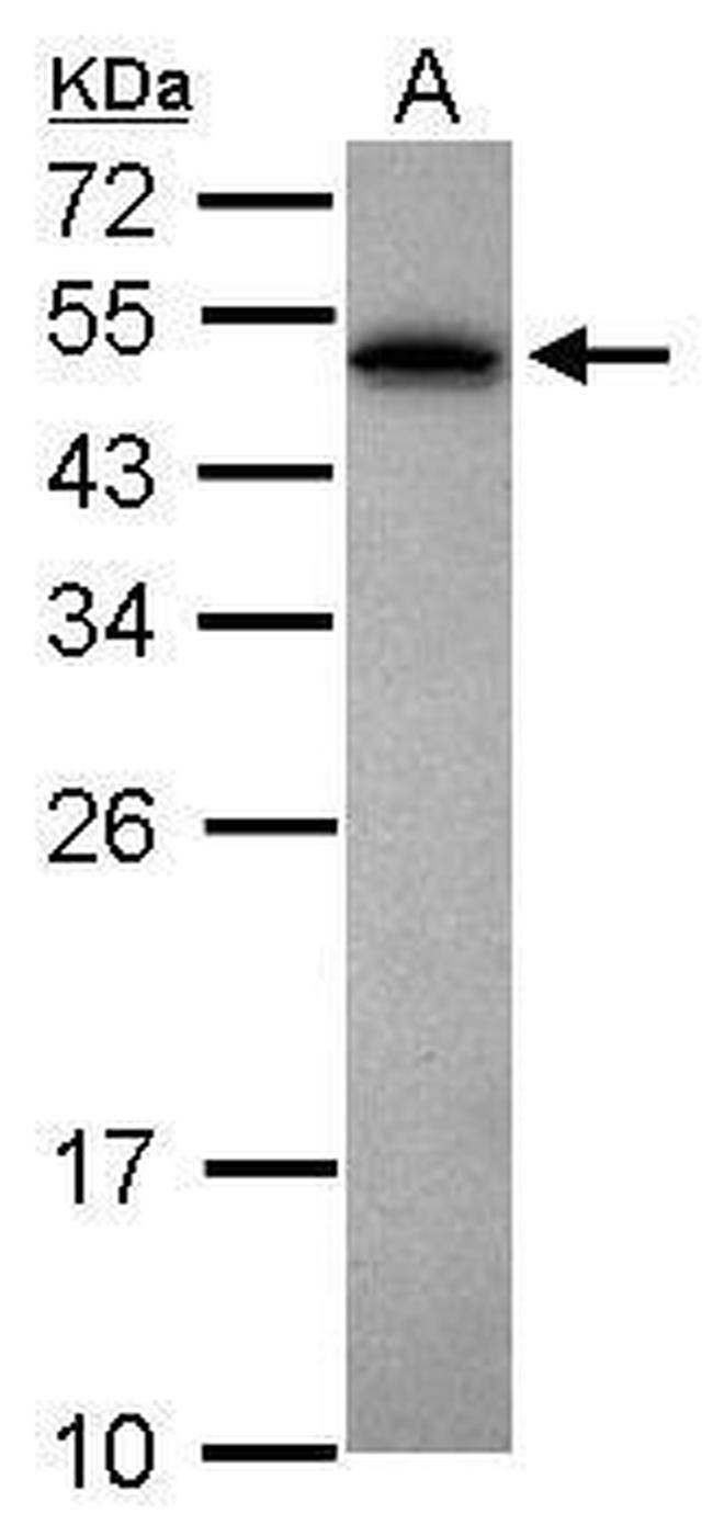 PABPN1 Antibody in Western Blot (WB)