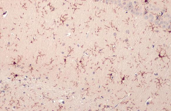 IBA1 Antibody in Immunohistochemistry (Paraffin) (IHC (P))