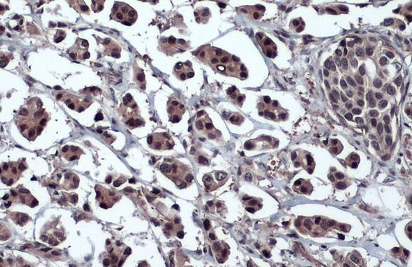 OCT4 Antibody in Immunohistochemistry (Paraffin) (IHC (P))