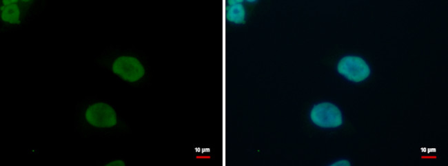 KLF4 Antibody in Immunocytochemistry (ICC/IF)