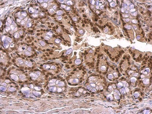 KLF4 Antibody in Immunohistochemistry (Paraffin) (IHC (P))