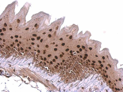 KLF4 Antibody in Immunohistochemistry (Paraffin) (IHC (P))