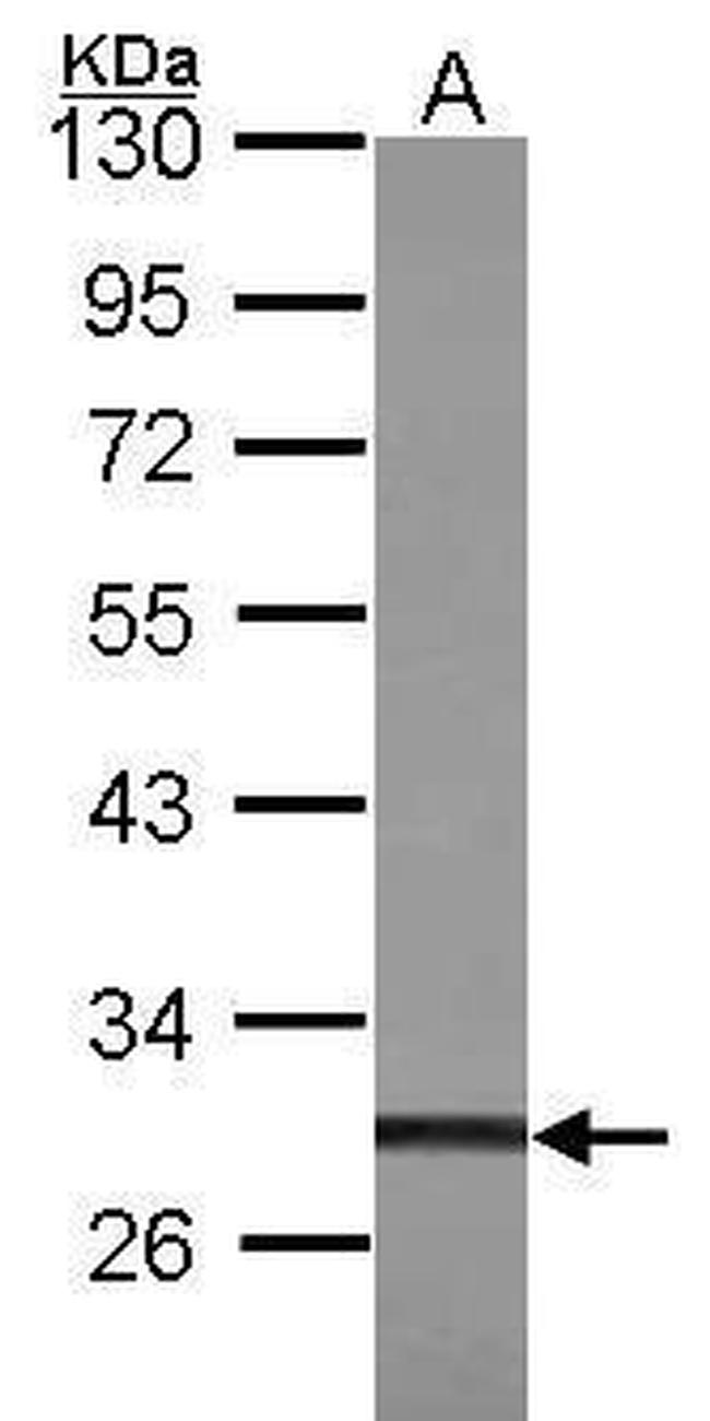 ZFP36L1 Antibody in Western Blot (WB)