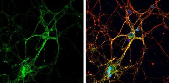 GAP43 Antibody in Immunocytochemistry (ICC/IF)