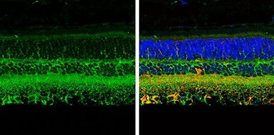 CRABP2 Antibody in Immunohistochemistry (Paraffin) (IHC (P))