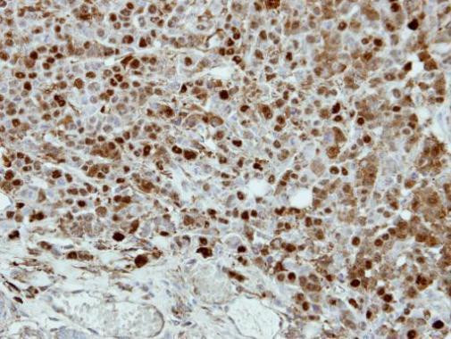 CRABP2 Antibody in Immunohistochemistry (Paraffin) (IHC (P))