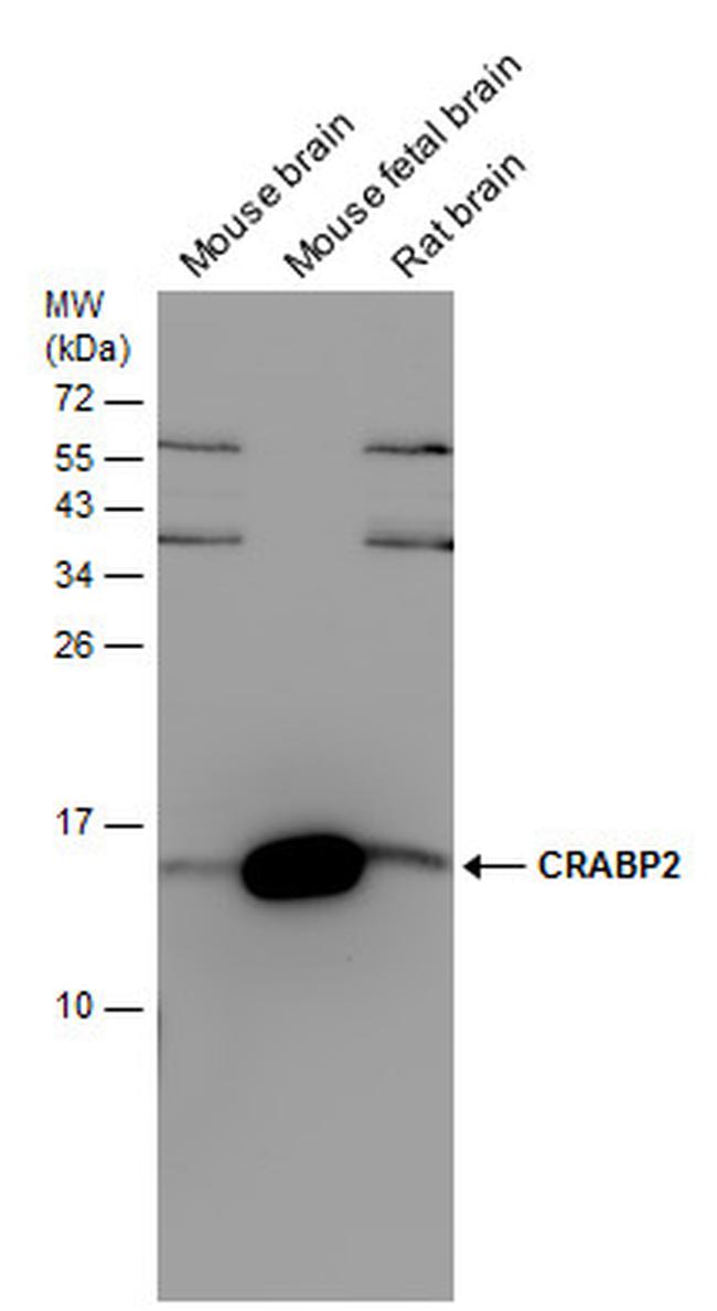 CRABP2 Antibody in Western Blot (WB)