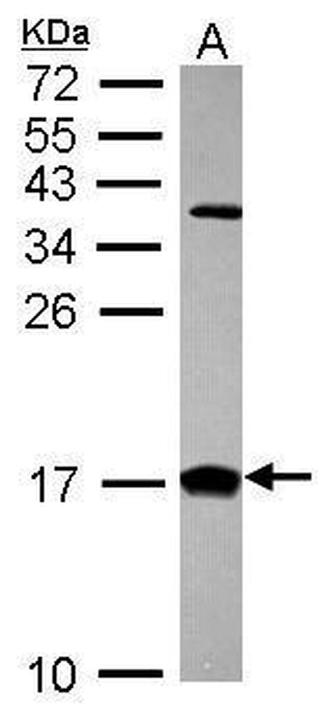 CRABP2 Antibody in Western Blot (WB)