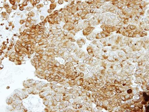 NSE Antibody in Immunohistochemistry (Paraffin) (IHC (P))