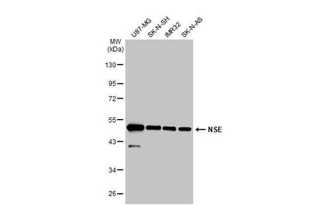 NSE Antibody in Western Blot (WB)