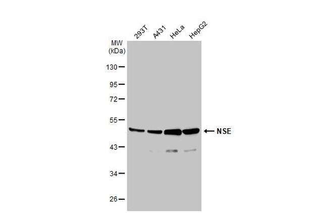 NSE Antibody in Western Blot (WB)