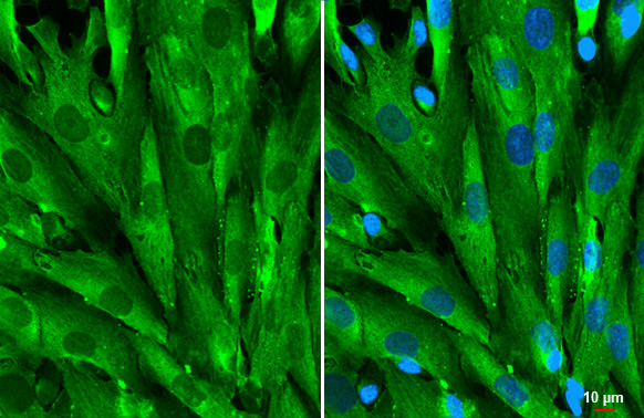 Galectin 1 Antibody in Immunocytochemistry (ICC/IF)