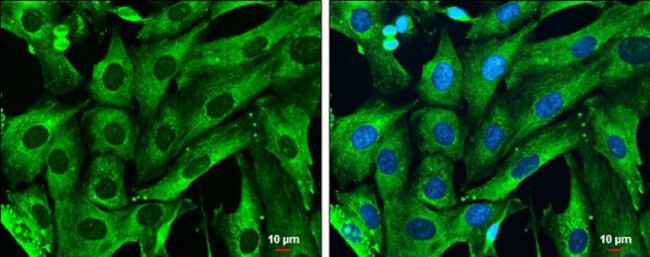 Galectin 1 Antibody in Immunocytochemistry (ICC/IF)