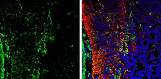 Galectin 1 Antibody in Immunohistochemistry (Frozen) (IHC (F))