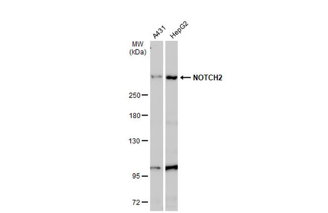 NOTCH2 Antibody in Western Blot (WB)
