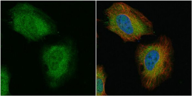 TAGLN Antibody in Immunocytochemistry (ICC/IF)