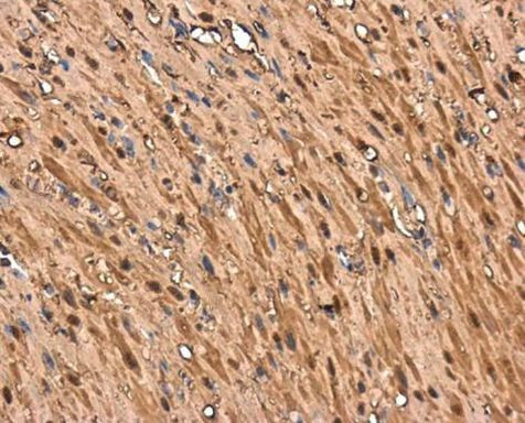 TAGLN Antibody in Immunohistochemistry (Paraffin) (IHC (P))